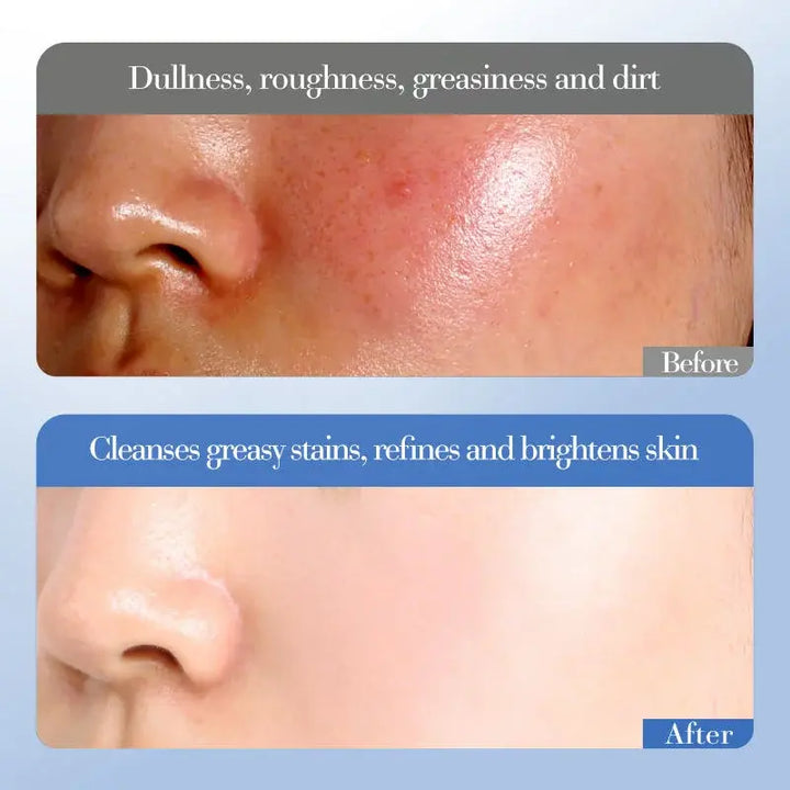 Deep Moisturizing Facial Cream – Illuminating with Niacinamide and Rice (50g)
